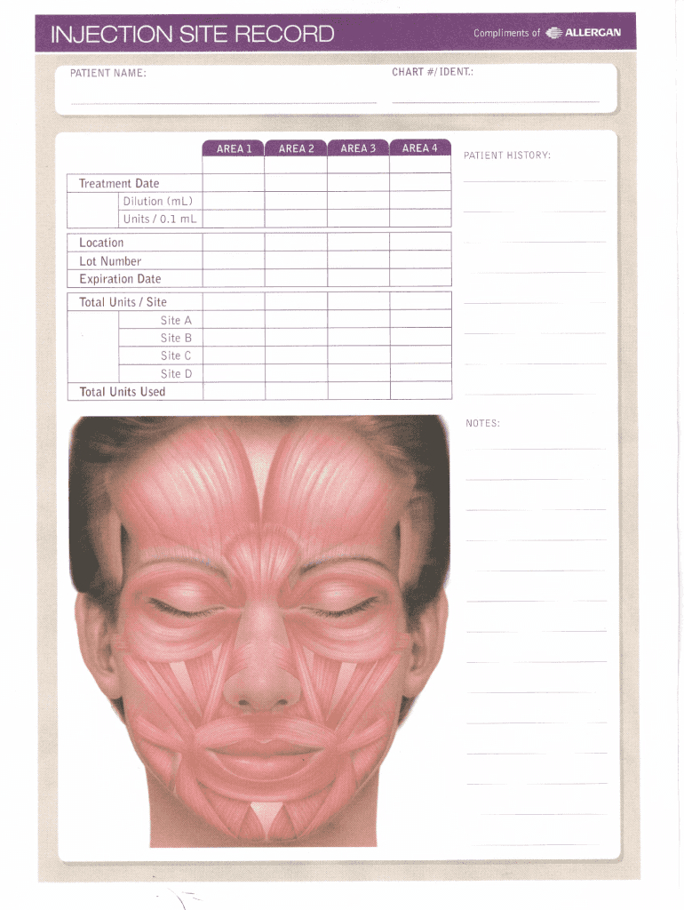 Printable Botox Face Chart - Fill Online, Printable, Fillable for Free Printable Botox Face Chart